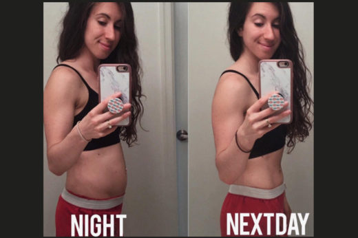 ไม่ได้อ้วน! สาวฟิตเนสโชว์ชัด ๆ ท้องราบ-มีพุง เพียงข้ามคืน เพราะโรคลำไส้แปรปรวน