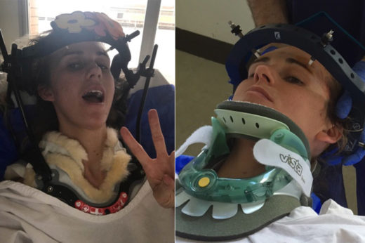 บอบบางเหลือเกิน สาวคอหัก 2 ครั้งซ้อน แค่เพราะ “จาม” กับ “หัวเราะ”