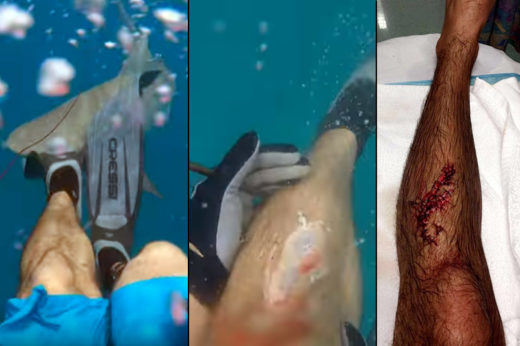 Jaws ของจริง!! คลิประทึกฉลามว่ายพุ่งงับขานักดำน้ำเนื้อหลุดวิ่น