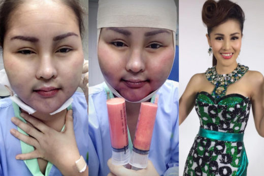 หญิงลีผ่าตัดดูดไขมัน โอดรอหายป่วยธรรมชาติไม่ไหว มีอีกหลายชีวิตที่รออยู่