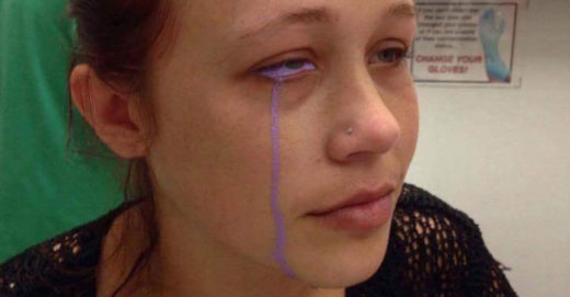 สาวร้องไห้น้ำตาเป็นสีม่วง หลังการทำ Eyeball Tattoo ผิดพลาด!