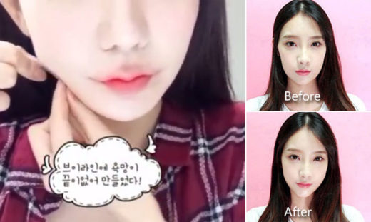 อู้ว้าว เสกหน้าเรียวไม่ต้องศัลย์! ด้วย “เทปดึงหน้าเรียว” เคล็ดลับหน้าวีเชฟแบบสาวเกาหลี