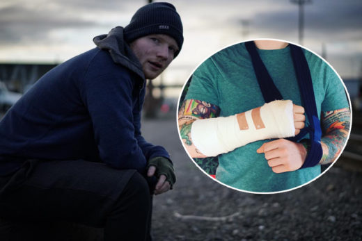 นักร้องหนุ่ม Ed Sheeran โพสต์ IG แจ้งประสบอุบัติเหตุแขนขวาหัก ส่อเลื่อนคอนเสิร์ต