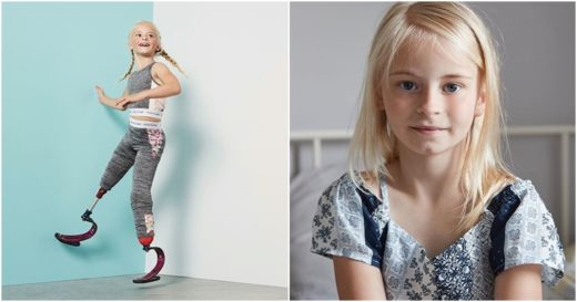 เจ๋งเลยยัยหนู สาวน้อย 7 ขวบพิการขา 2 ข้าง เป็นนางแบบเสื้อผ้ากีฬาเด็ก